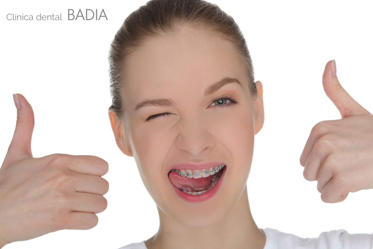 ortodoncia-agradable