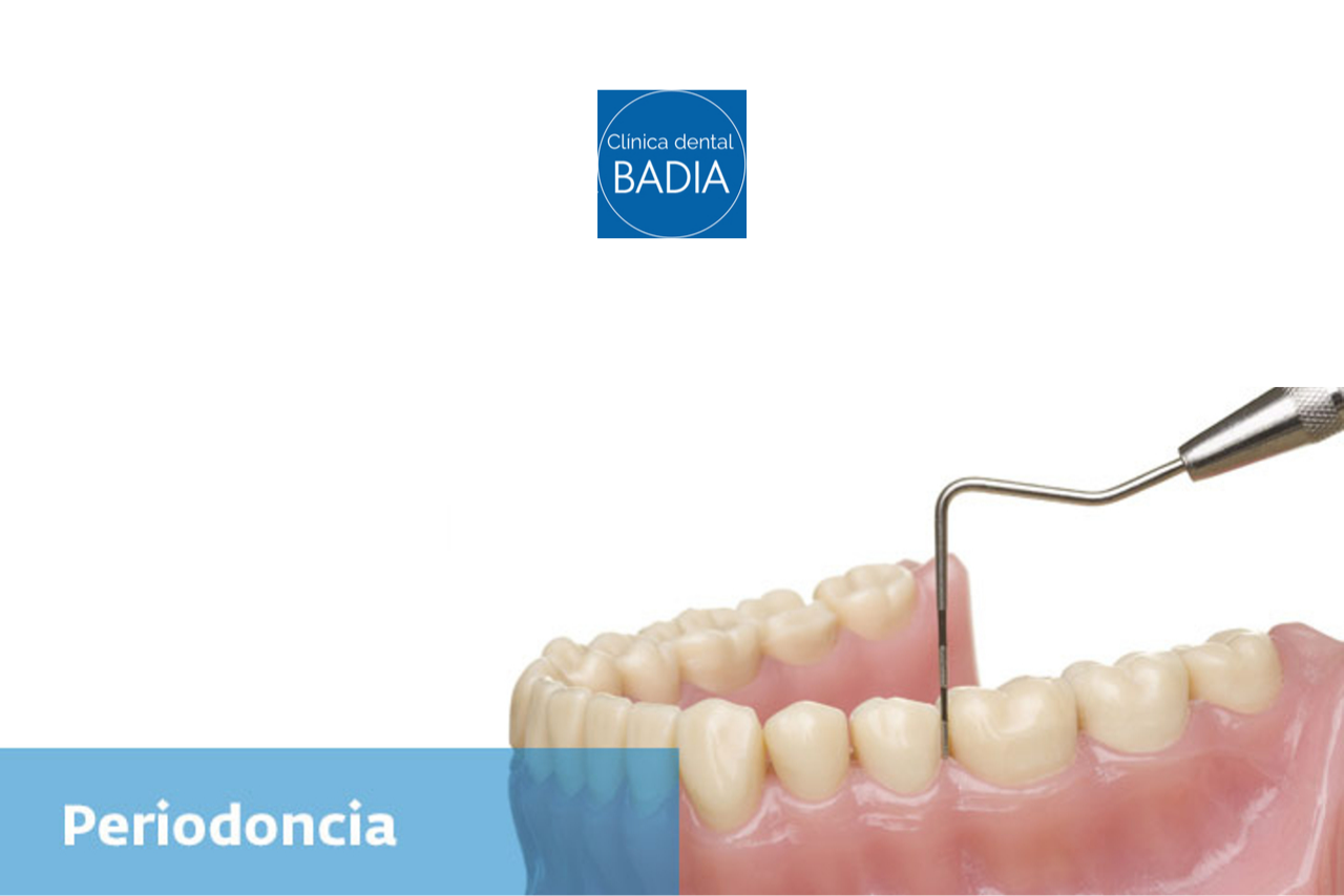 periodoncia