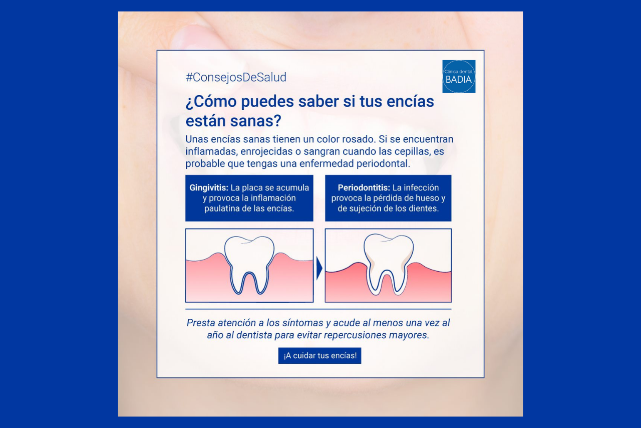 tus-encias-estan-sanas