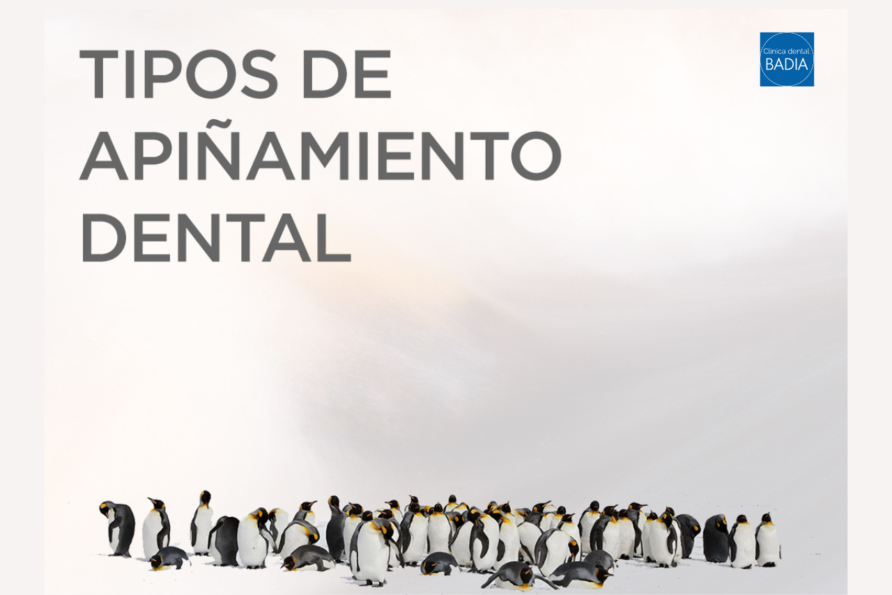 apiñamiento-dental