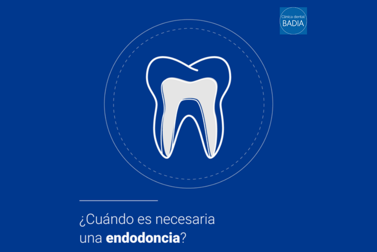 cuando-necesaria-endodoncia