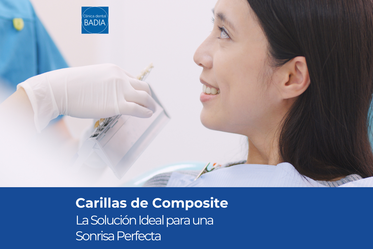 Carillas de Composite