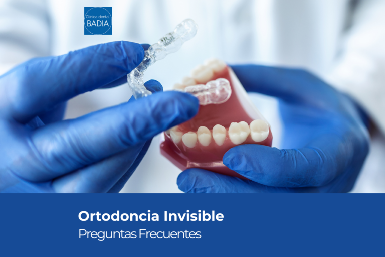 Ortodoncia Invisible