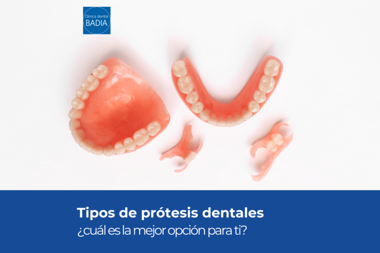 tipos de prótesis dentales