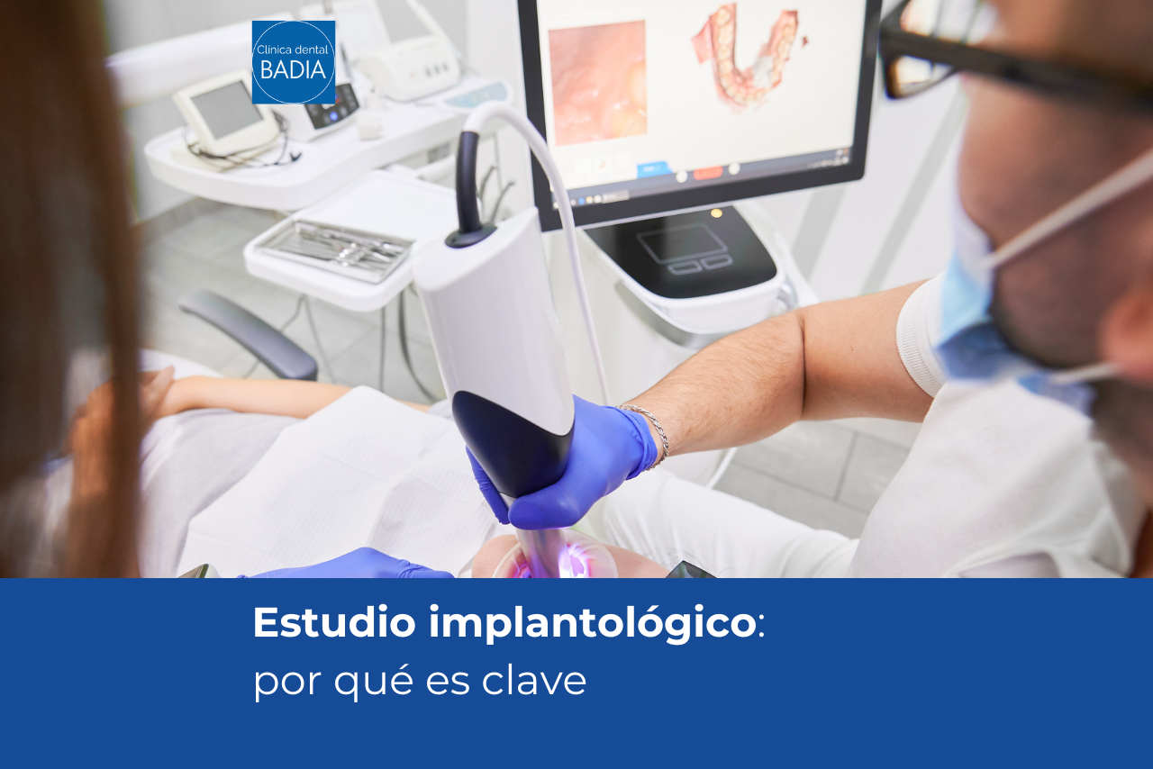 Estudio implantológico: por qué es clave