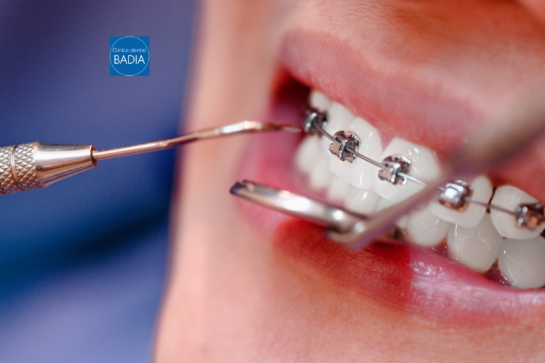 higiene dental ortodoncia