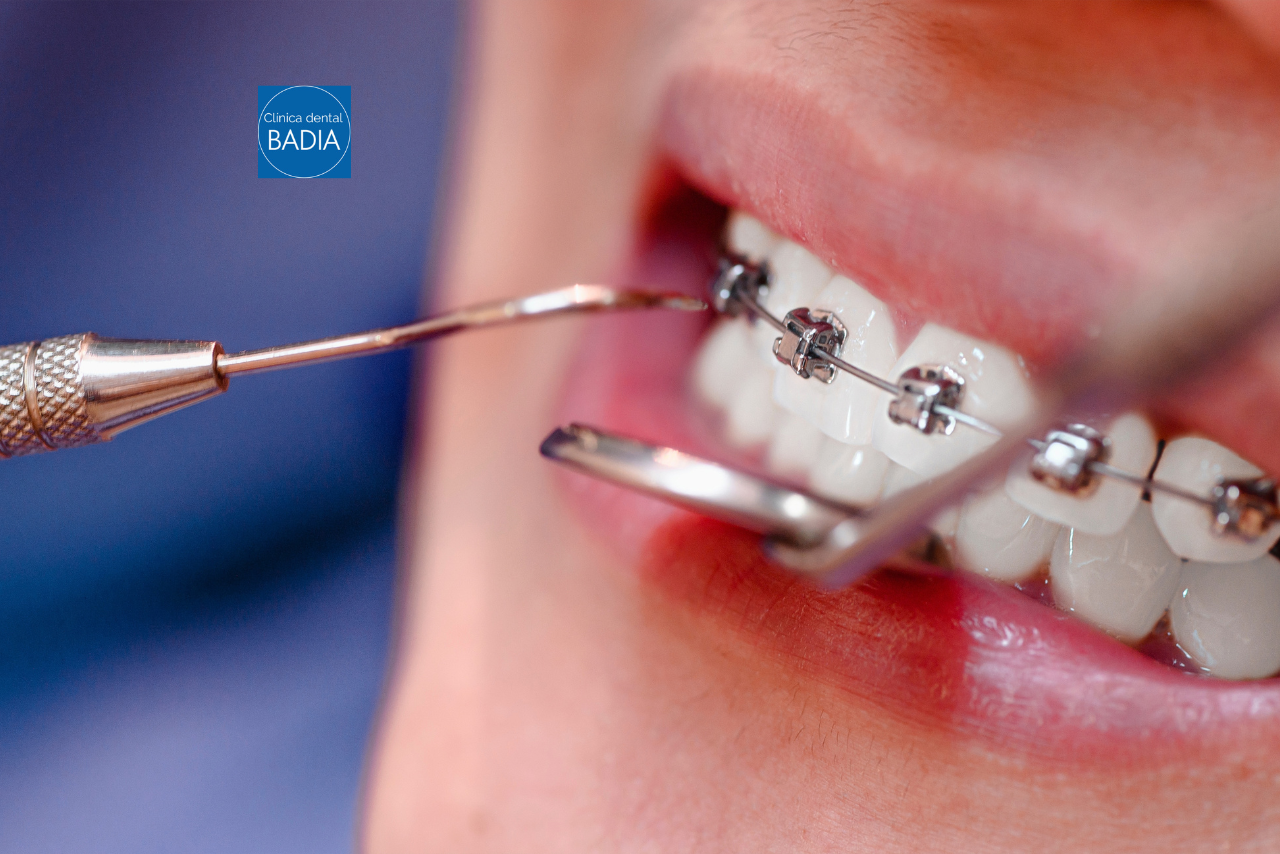 higiene dental ortodoncia
